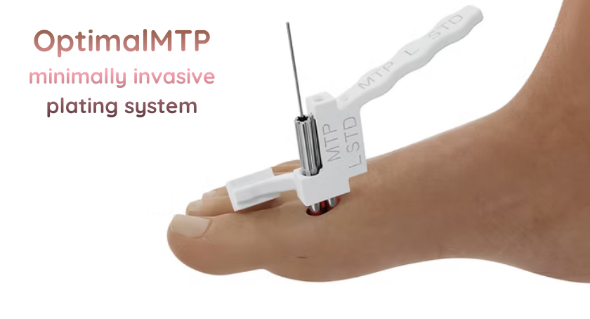 Forma Medical Issued Key Methods Patent